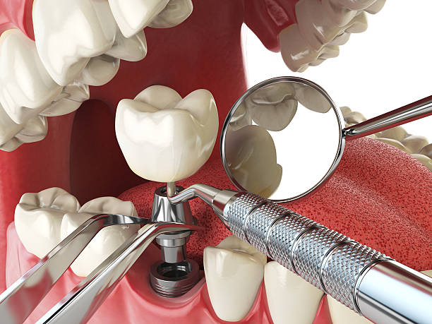 Reliable ND Emergency Dentist Solutions