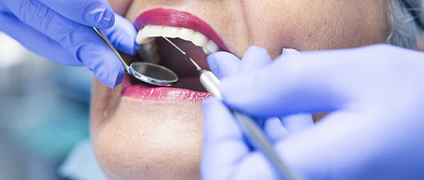 Best Emergency Gum Treatment in Washburn, ND